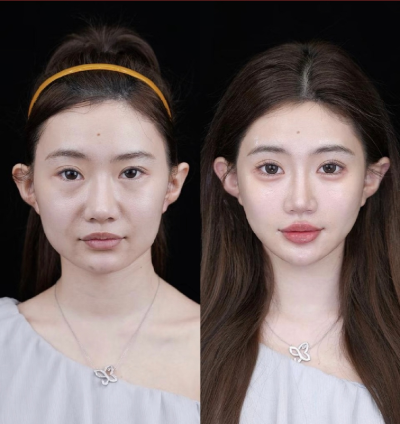 上海伊莱美医疗美容医院：规范收费保护权益