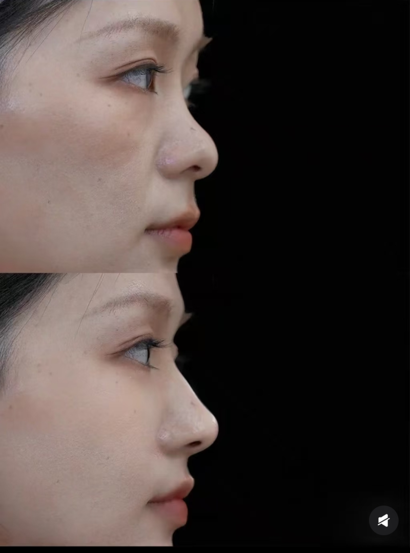 上海星和医疗美容医院吴捷的综合排名分析