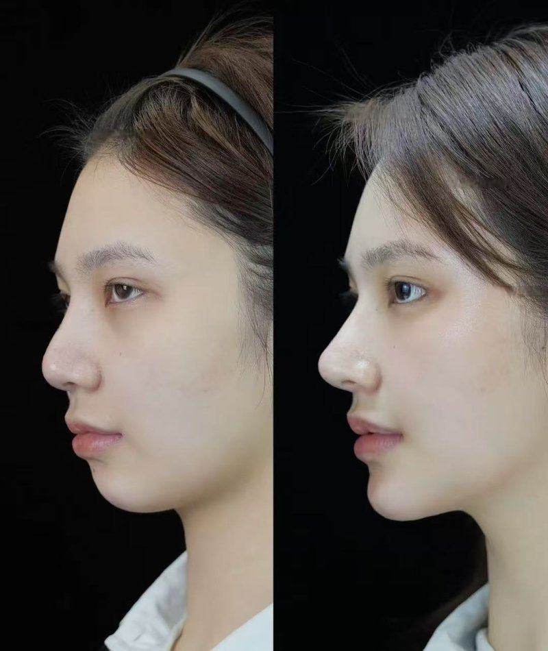 深圳米兰柏羽医疗美容医院朱武根个人资料公布，揭秘他擅长的医美项目及独特技术优势！ 