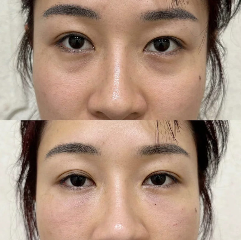 深圳米兰柏羽医疗美容医院的服务项目