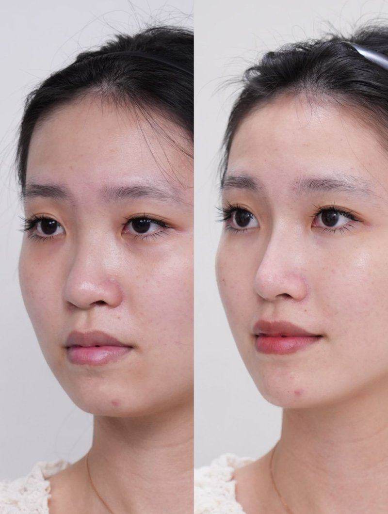 深圳米兰柏羽医疗美容医院的一些争议