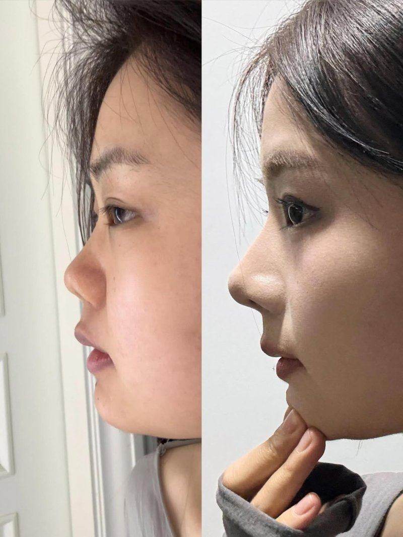 张家口维多利亚医疗美容医院：价格透明合理