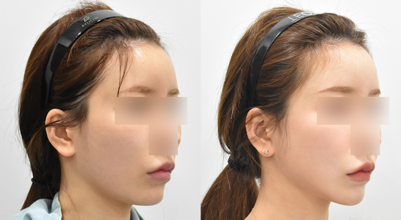 上海星和医疗美容医院吴捷的患者口碑