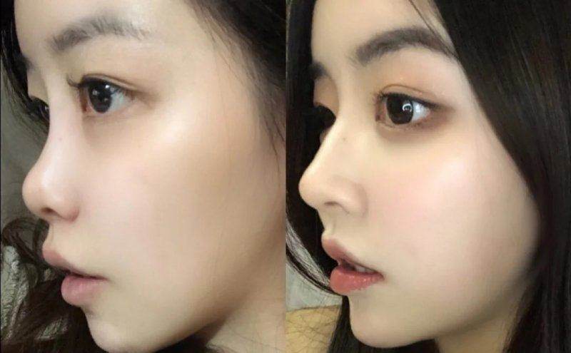 张家口维多利亚医疗美容医院公交怎么坐？看这篇攻略，轻松找到便捷乘车路线！ 