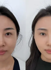 深圳米兰柏羽医疗美容医院怎么乘地铁去？别愁，这篇攻略给你说明白，让你轻松到院！ 