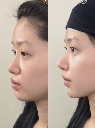 轻松到院,开启美丽之旅