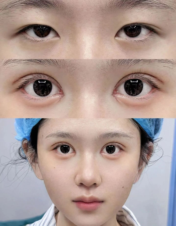 张家口维多利亚医疗美容医院宋莹洁医生——专精与美的化身