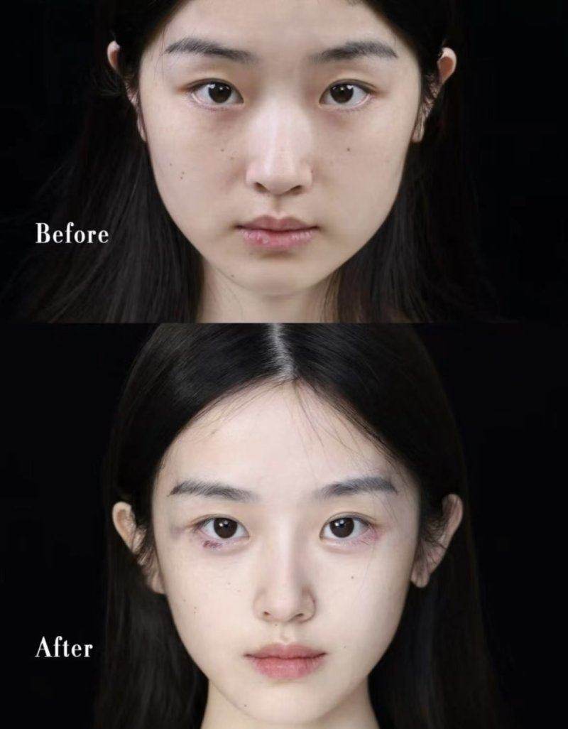 上海市口碑排名前十的医美医院有哪些？为你揭秘靠谱医美机构，让变美之路更安心！ 