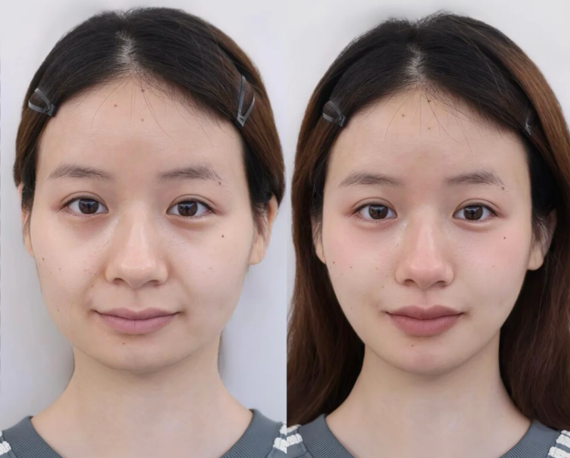 上海美莱医疗美容医院