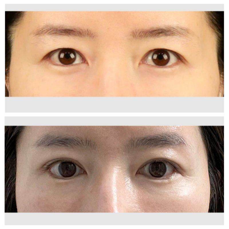 合肥美雅尔口腔门诊部公交怎么坐？别愁，这篇攻略给你讲清乘车路线！ 