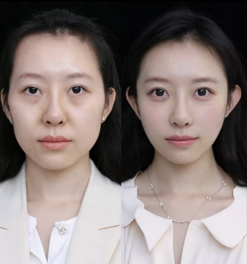 选择上海星和医疗美容医院的建议