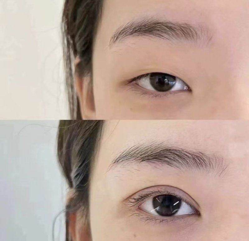 深圳米兰柏羽医疗美容医院的热门项目