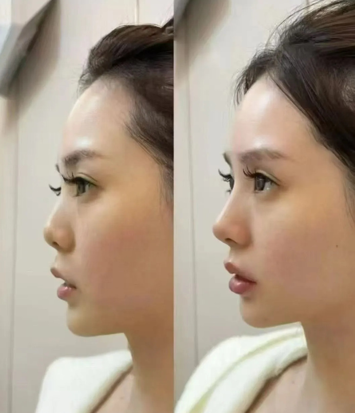 上海薇琳医疗美容医院：性价比高的收费模式