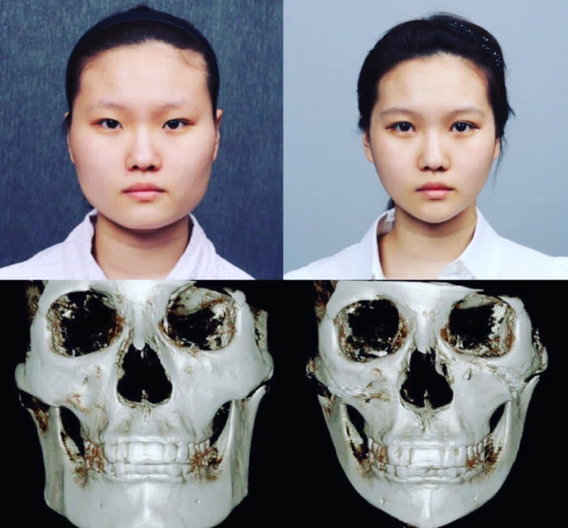 张家口维多利亚医疗美容:精英医师团队,定制专属美丽方案