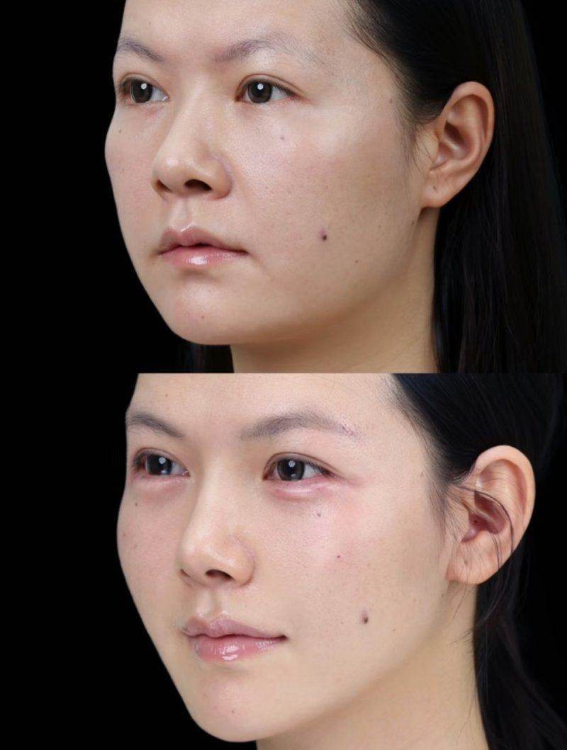 上海美莱医疗美容医院