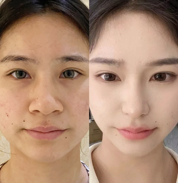 深圳米兰柏羽医疗美容医院的环境与收费