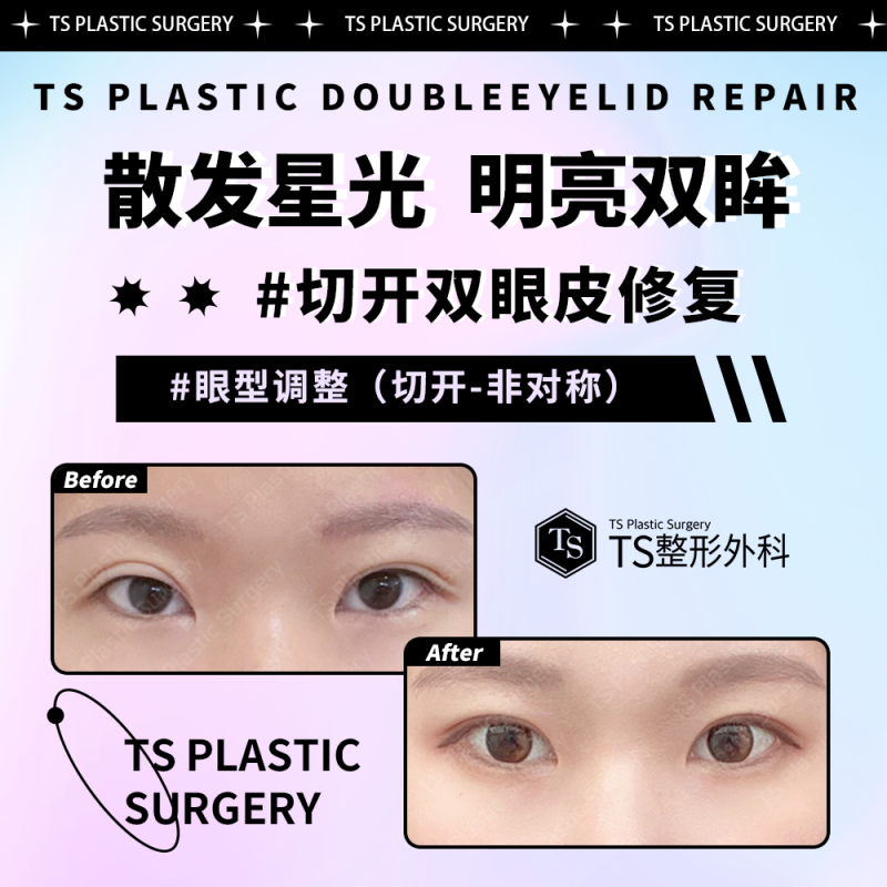 安徽合肥美雅尔口腔门诊部收费标准