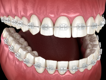 綿陽中綿口腔醫院是不是正規醫院？揭曉真相，讓你放心看牙不踩坑！ 