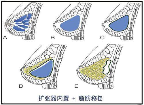 医疗技术与专精团队