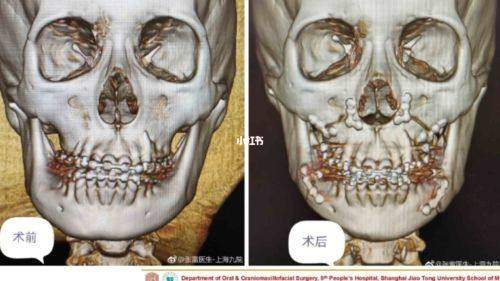 选择正规医美机构，北京医院整形外科是理想之选