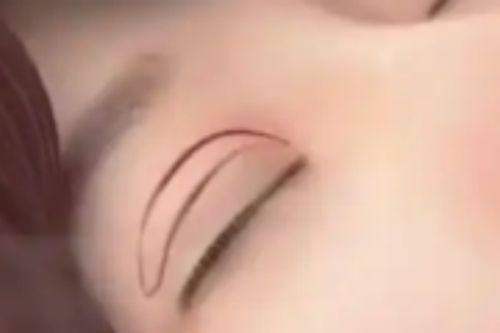 常州宸梦医疗美容诊所网友关注