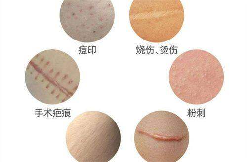 常州宸梦医疗美容诊所收费标准咋样？揭秘常见医美项目收费行情，不花冤枉钱 