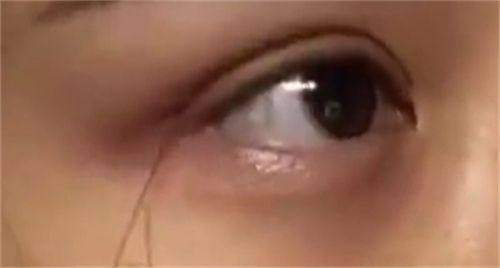 医美市场乱象需谨慎