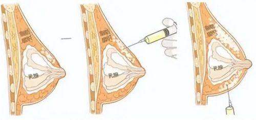 成功实例见证实力