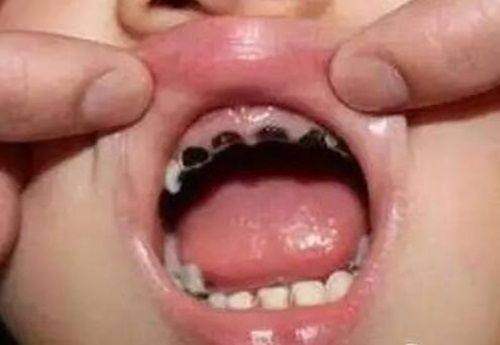 晉中牙博士口腔診所靠譜嗎？正規性+技術+口碑三重驗證