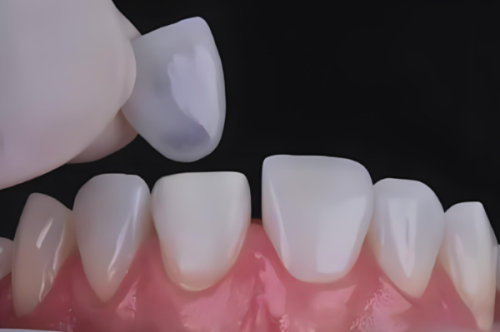 臨沂壹顆芽口腔醫院收費標準大揭秘！價格合理，讓你花錢花得明明白白！ 