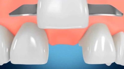 北京永林口腔医院的价格优势