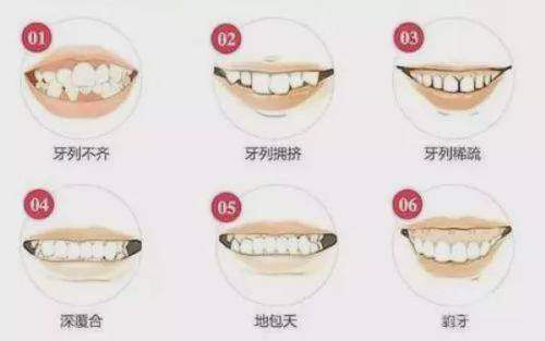 晉中牙博士口腔診所收費貴嗎？價格表透明且親民