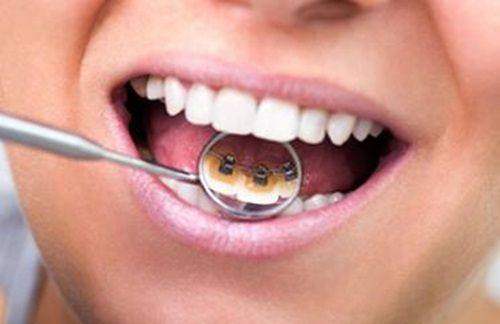 临沂壹颗芽口腔医院技术靠谱吗？实力见真章