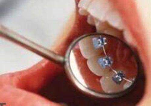 关于牙科医疗保险使用的一般情况