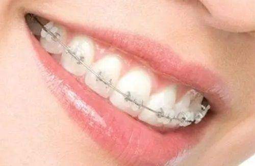 深圳瑞吉口腔診所的優勢