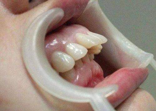 晉中牙博士口腔診所收費貴嗎？價格表透明且親民