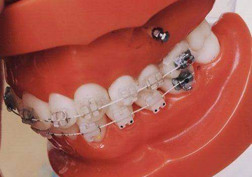 番禺區口腔診所林立，貝美口腔有何特色