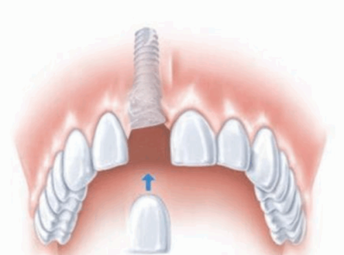 臨沂壹顆芽口腔醫院的醫生團隊