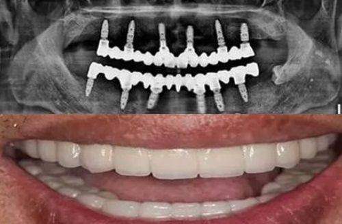 北京中腾口腔医院性价比总结