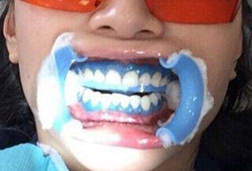 北京永林口腔医院的贴心服务