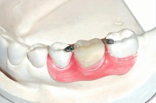 患者口碑與实例