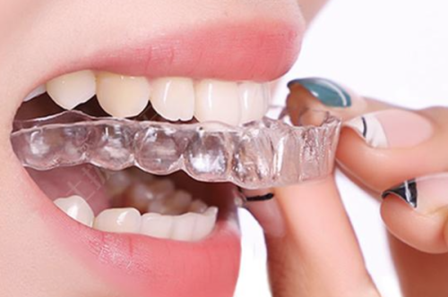 臨沂壹顆芽口腔醫院的服務特色