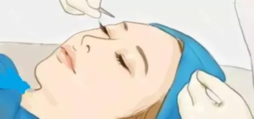 北京五维医疗美容医院郭弘义和赵星星哪个更靠谱？看完他们的案例和口碑你就有答案！ 