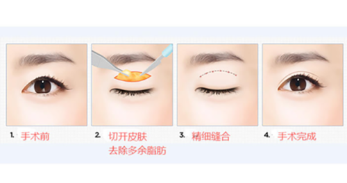 北京其他有名整形外科医院地址及特色