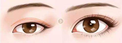 常州宸梦医疗美容诊所的行业口碑与网友评价