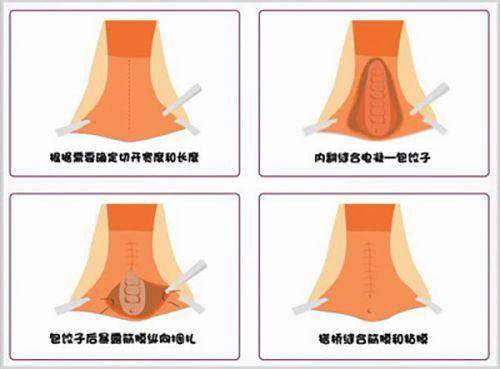 选择医美机构的要点