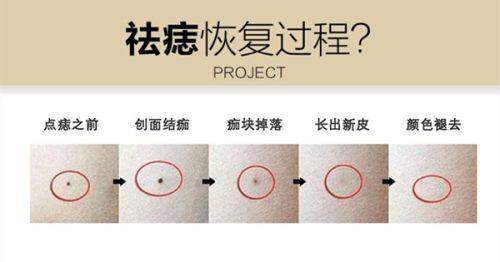 北京医院鲍世威医生的医美成就