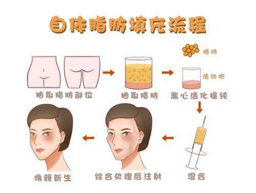 常州曙光医疗美容医院公交怎么坐？别愁，这就给你详细说说乘车路线！ 