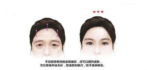 回到郭弘义和赵星星