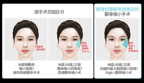 北京医院整形外科坑不坑？听听做过整形的人怎么说，给你最真实的答案！ 